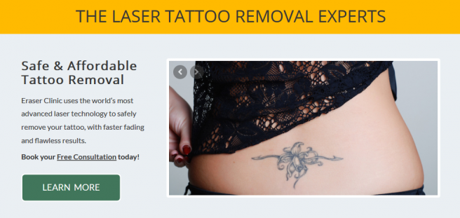 Eraser Clinic Alternatives (Tattoo Removal Clinic in Austin TX) -  Alternatives